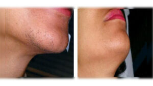 آکادمی تخصصی پوست و مو زیبایی گود اسکین,ریموو تتو با لیزر,لیزر واریس,پیرسینگ,فیبروز ابرو,میکروبلیدینگ,دستگاههای پوستی,پاکسازی پوست,موهای زیر پوستی,جوش باز,موهای زائد هورمونی