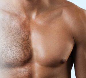 آکادمی تخصصی پوست و مو زیبایی گود اسکین,ریموو تتو با لیزر,لیزر واریس,پیرسینگ,فیبروز ابرو,میکروبلیدینگ,دستگاههای پوستی,پاکسازی پوست,موهای زیر پوستی,جوش باز,موهای زائد هورمونی